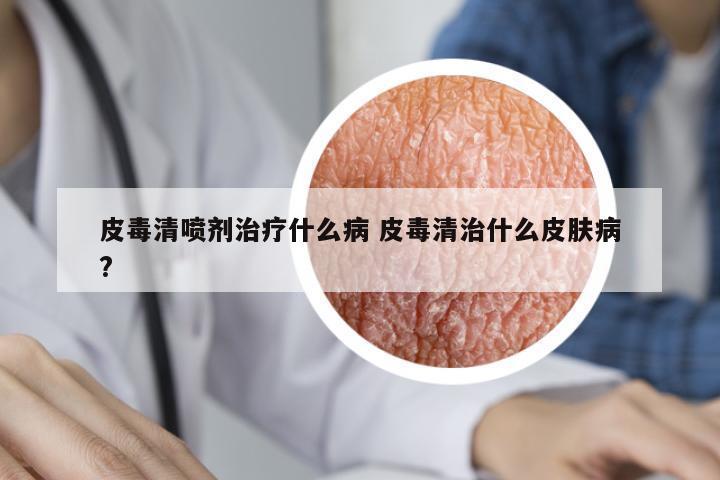 皮毒清噴劑治療什么病 皮毒清治什么皮膚病?