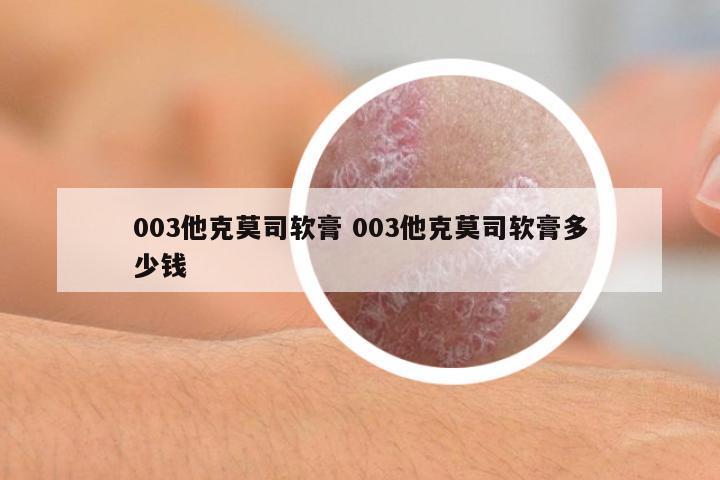 003他克莫司軟膏 003他克莫司軟膏多少錢