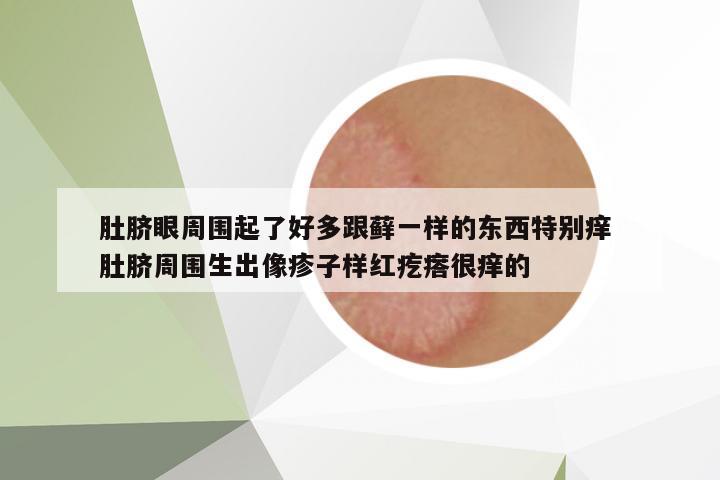 肚臍眼周圍起了好多跟蘚一樣的東西特別癢 肚臍周圍生出像疹子樣紅疙瘩很癢的