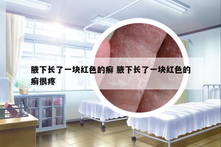 腋下長(zhǎng)了一塊紅色的癬 腋下長(zhǎng)了一塊紅色的癬很疼