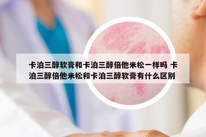 卡泊三醇軟膏和卡泊三醇倍他米松一樣嗎 卡泊三醇倍他米松和卡泊三醇軟膏有什么區(qū)別