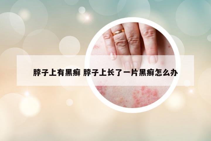 脖子上有黑癬 脖子上長(zhǎng)了一片黑癬怎么辦