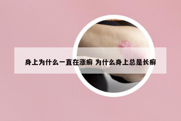 身上為什么一直在漲癬 為什么身上總是長(zhǎng)癬
