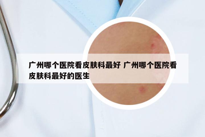廣州哪個醫(yī)院看皮膚科最好 廣州哪個醫(yī)院看皮膚科最好的醫(yī)生