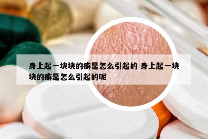 身上起一塊塊的癬是怎么引起的 身上起一塊塊的癬是怎么引起的呢