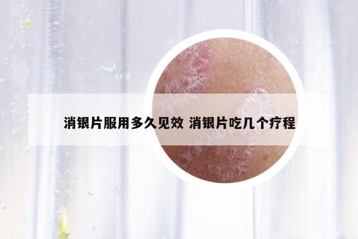 消銀片服用多久見效 消銀片吃幾個療程