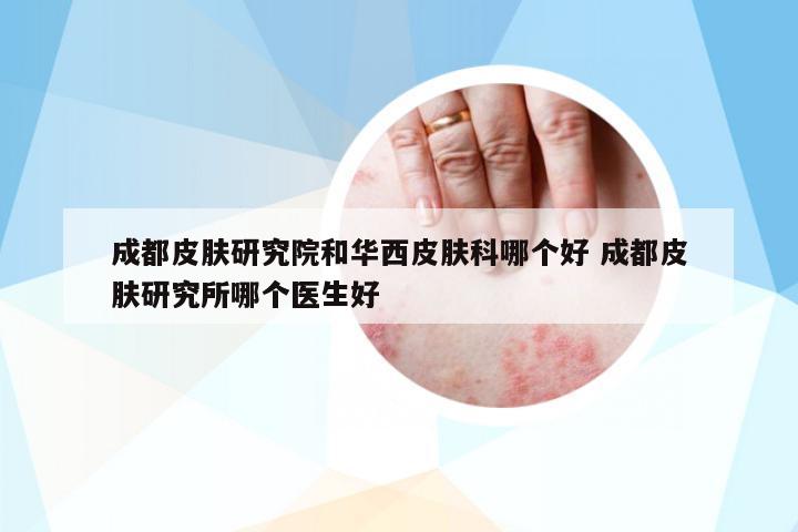 成都皮膚研究院和華西皮膚科哪個(gè)好 成都皮膚研究所哪個(gè)醫(yī)生好