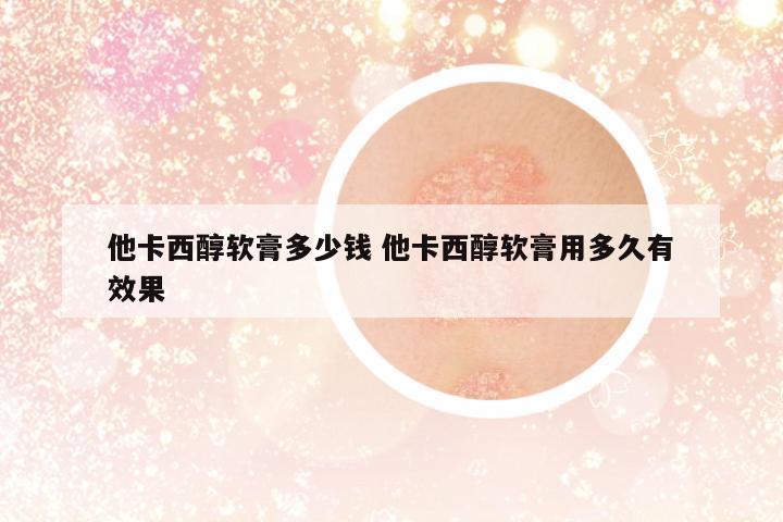 他卡西醇軟膏多少錢 他卡西醇軟膏用多久有效果
