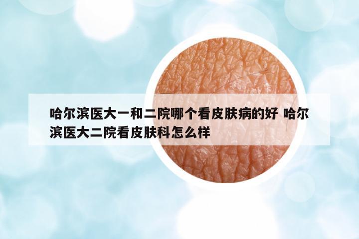 哈爾濱醫(yī)大一和二院哪個看皮膚病的好 哈爾濱醫(yī)大二院看皮膚科怎么樣