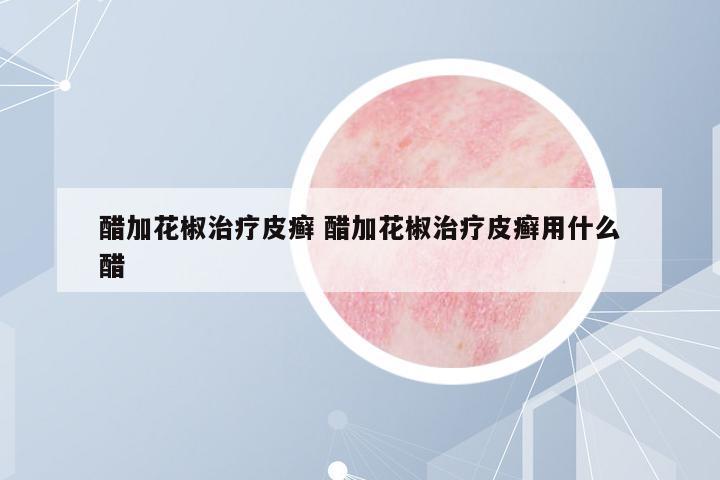 醋加花椒治療皮癬 醋加花椒治療皮癬用什么醋