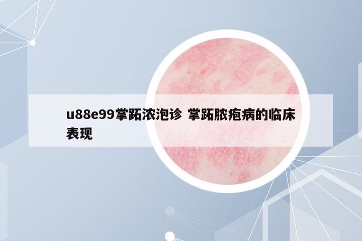 u88e99掌跖濃泡診 掌跖膿皰病的臨床表現(xiàn)