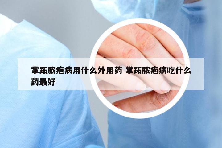 掌跖膿皰病用什么外用藥 掌跖膿皰病吃什么藥最好