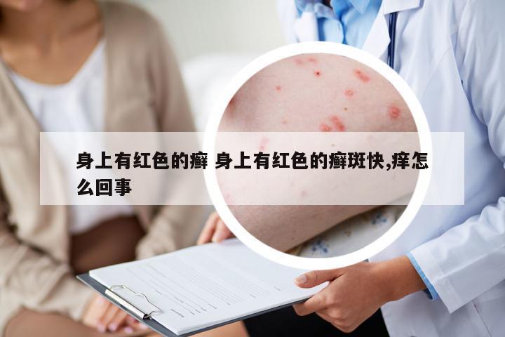 身上有紅色的癬 身上有紅色的癬斑快,癢怎么回事