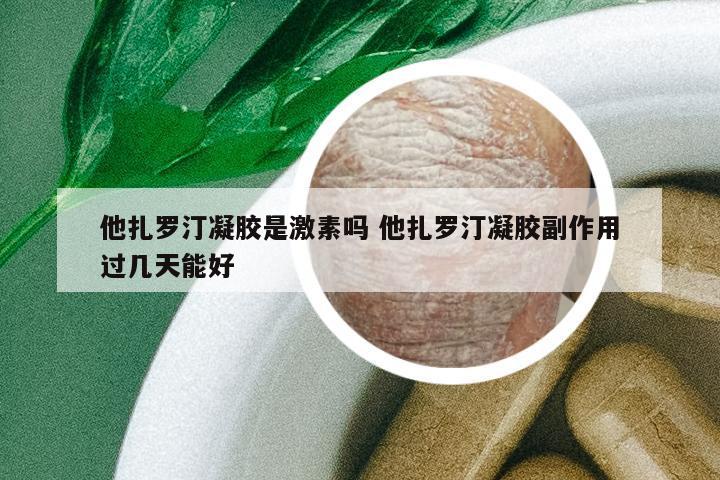 他扎羅汀凝膠是激素嗎 他扎羅汀凝膠副作用過幾天能好