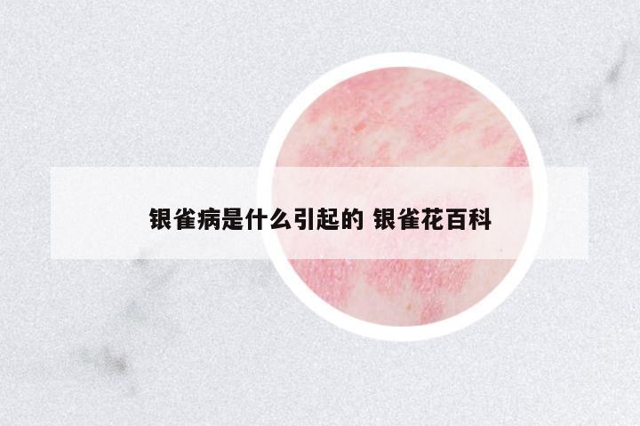 銀雀病是什么引起的 銀雀花百科