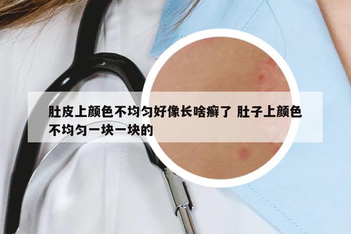 肚皮上顏色不均勻好像長啥癬了 肚子上顏色不均勻一塊一塊的