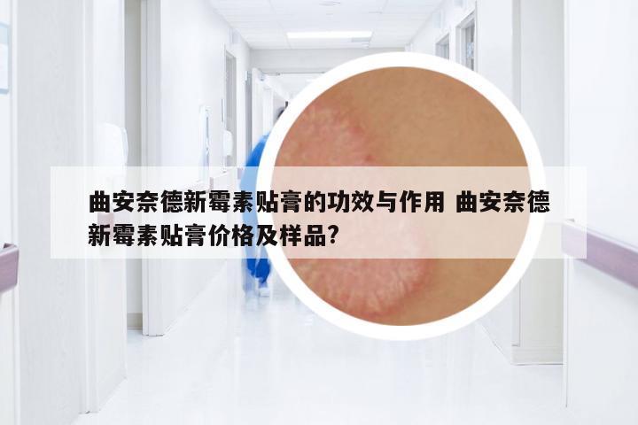 曲安奈德新霉素貼膏的功效與作用 曲安奈德新霉素貼膏價格及樣品?