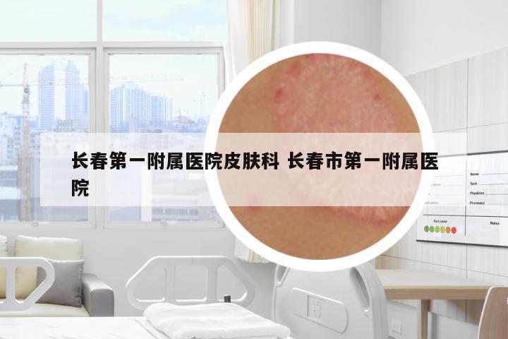 長春第一附屬醫(yī)院皮膚科 長春市第一附屬醫(yī)院