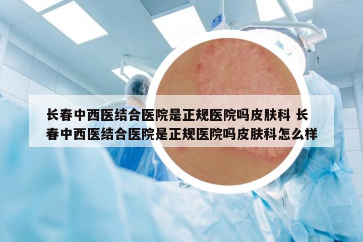長(zhǎng)春中西醫(yī)結(jié)合醫(yī)院是正規(guī)醫(yī)院?jiǎn)崞つw科 長(zhǎng)春中西醫(yī)結(jié)合醫(yī)院是正規(guī)醫(yī)院?jiǎn)崞つw科怎么樣