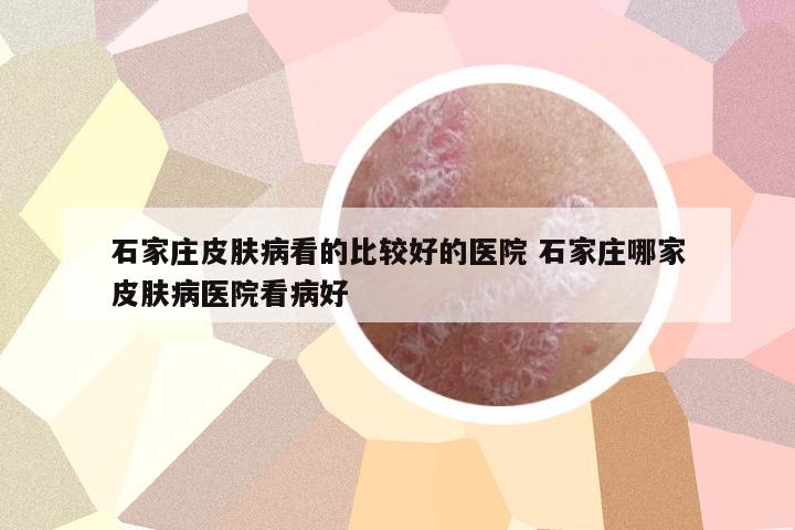 石家莊皮膚病看的比較好的醫(yī)院 石家莊哪家皮膚病醫(yī)院看病好