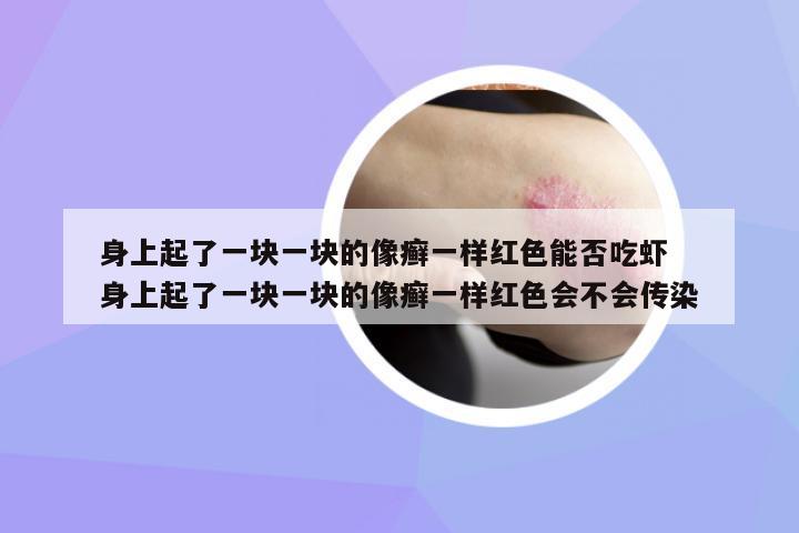 身上起了一塊一塊的像癬一樣紅色能否吃蝦 身上起了一塊一塊的像癬一樣紅色會不會傳染