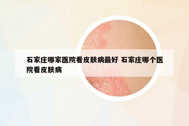 石家莊哪家醫(yī)院看皮膚病最好 石家莊哪個(gè)醫(yī)院看皮膚病