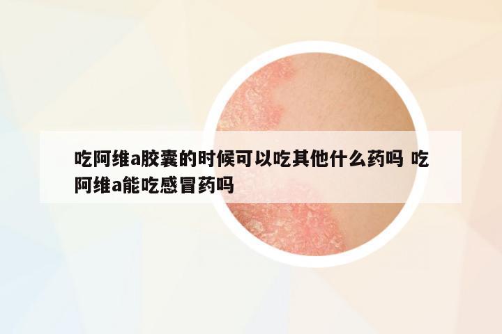 吃阿維a膠囊的時(shí)候可以吃其他什么藥嗎 吃阿維a能吃感冒藥嗎