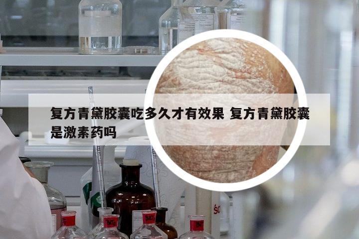 復(fù)方青黛膠囊吃多久才有效果 復(fù)方青黛膠囊是激素藥嗎