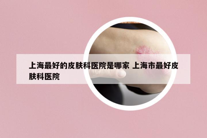 上海最好的皮膚科醫(yī)院是哪家 上海市最好皮膚科醫(yī)院