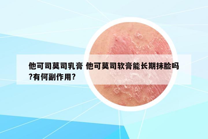 他可司莫司乳膏 他可莫司軟膏能長(zhǎng)期抹臉嗎?有何副作用?