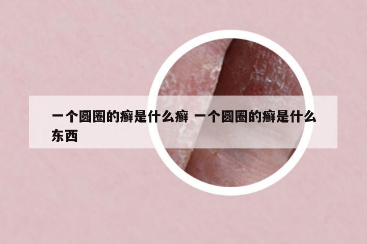 一個(gè)圓圈的癬是什么癬 一個(gè)圓圈的癬是什么東西