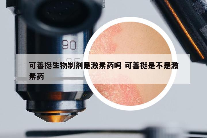 可善挺生物制劑是激素藥嗎 可善挺是不是激素藥