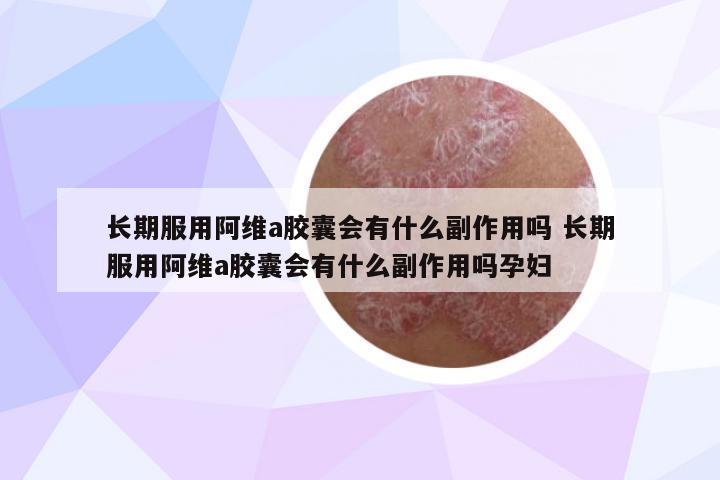 長期服用阿維a膠囊會有什么副作用嗎 長期服用阿維a膠囊會有什么副作用嗎孕婦