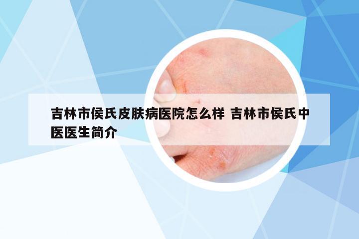 吉林市侯氏皮膚病醫(yī)院怎么樣 吉林市侯氏中醫(yī)醫(yī)生簡介