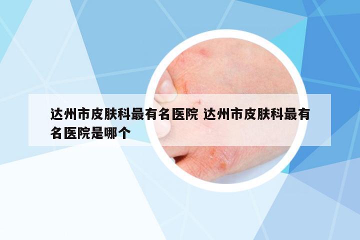 達(dá)州市皮膚科最有名醫(yī)院 達(dá)州市皮膚科最有名醫(yī)院是哪個(gè)