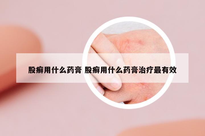 股癬用什么藥膏 股癬用什么藥膏治療最有效