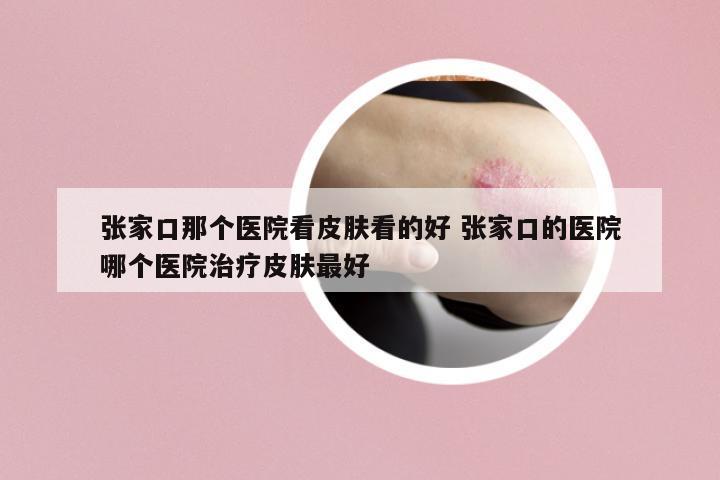 張家口那個(gè)醫(yī)院看皮膚看的好 張家口的醫(yī)院哪個(gè)醫(yī)院治療皮膚最好