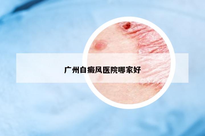 廣州白癜風(fēng)醫(yī)院哪家好