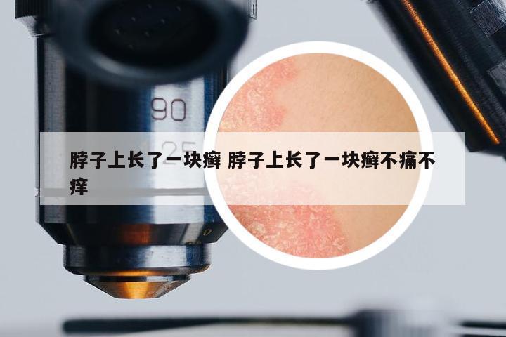 脖子上長了一塊癬 脖子上長了一塊癬不痛不癢