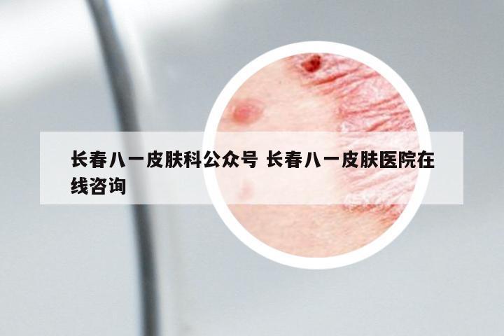 長春八一皮膚科公眾號 長春八一皮膚醫(yī)院在線咨詢