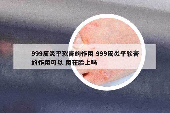 999皮炎平軟膏的作用 999皮炎平軟膏的作用可以 用在臉上嗎
