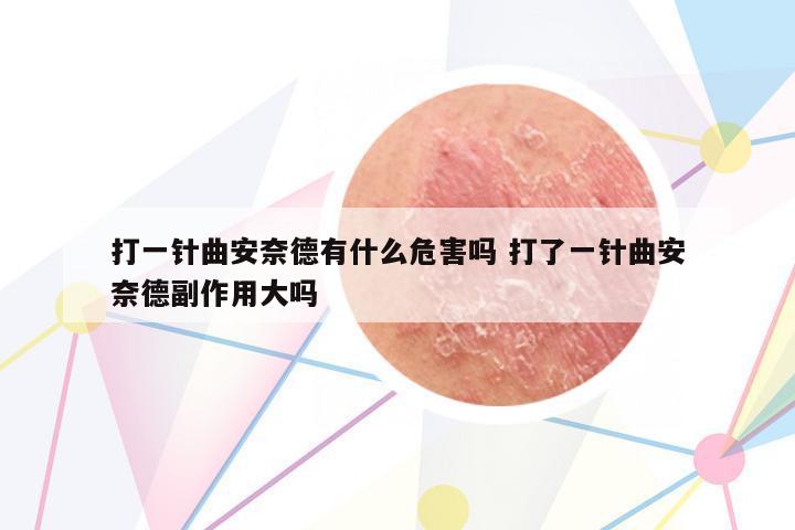 打一針曲安奈德有什么危害嗎 打了一針曲安奈德副作用大嗎