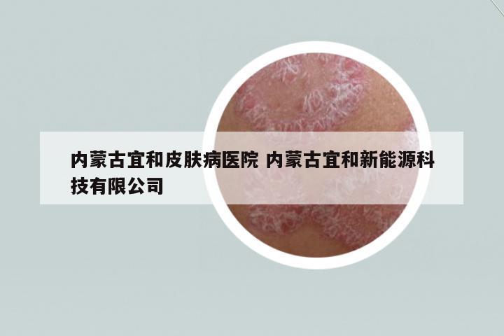 內(nèi)蒙古宜和皮膚病醫(yī)院 內(nèi)蒙古宜和新能源科技有限公司