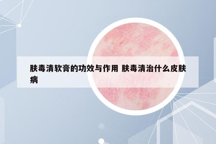 膚毒清軟膏的功效與作用 膚毒清治什么皮膚病