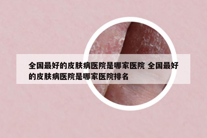 全國最好的皮膚病醫(yī)院是哪家醫(yī)院 全國最好的皮膚病醫(yī)院是哪家醫(yī)院排名