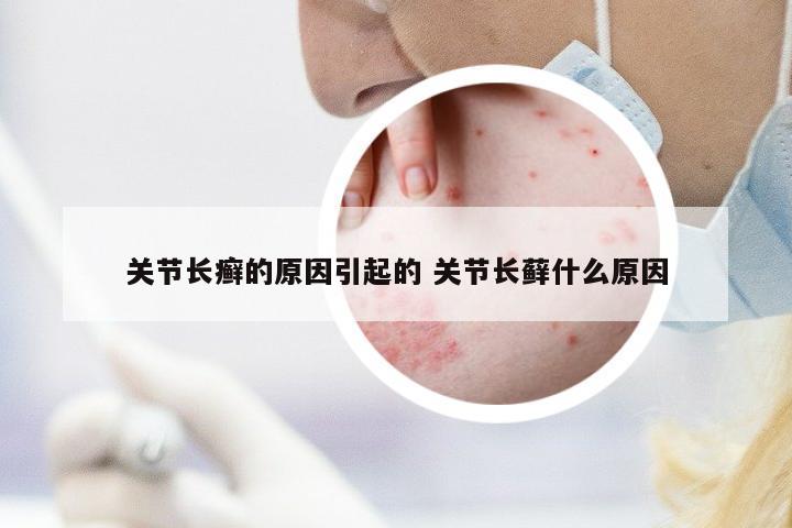 關(guān)節(jié)長(zhǎng)癬的原因引起的 關(guān)節(jié)長(zhǎng)蘚什么原因