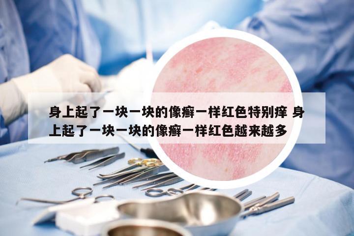 身上起了一塊一塊的像癬一樣紅色特別癢 身上起了一塊一塊的像癬一樣紅色越來越多