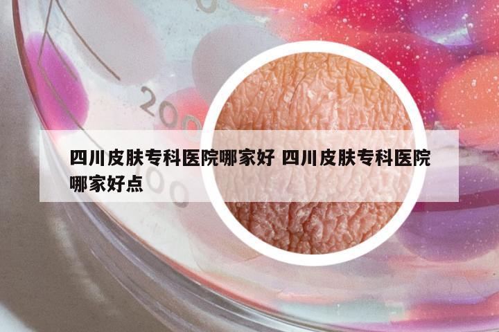 四川皮膚專(zhuān)科醫(yī)院哪家好 四川皮膚專(zhuān)科醫(yī)院哪家好點(diǎn)