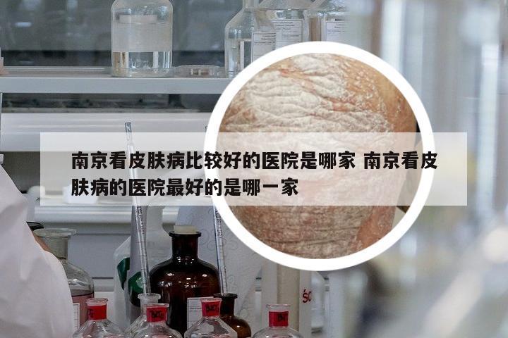 南京看皮膚病比較好的醫(yī)院是哪家 南京看皮膚病的醫(yī)院最好的是哪一家