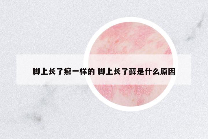 腳上長了癬一樣的 腳上長了蘚是什么原因